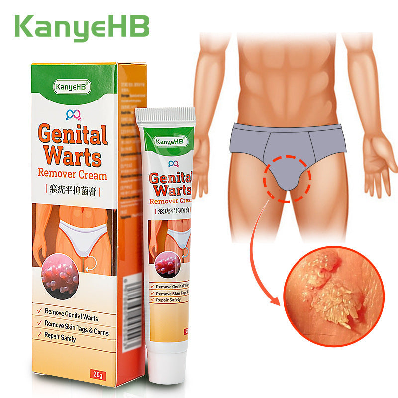 Wart Remover Cream