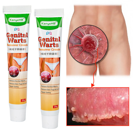 Wart Remover Cream